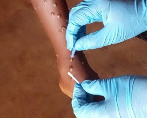 mpox-vaccine-rollout-to-begin-in-nigeria,-drc