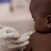 Northern states record highest suspected measles cases – NCDC