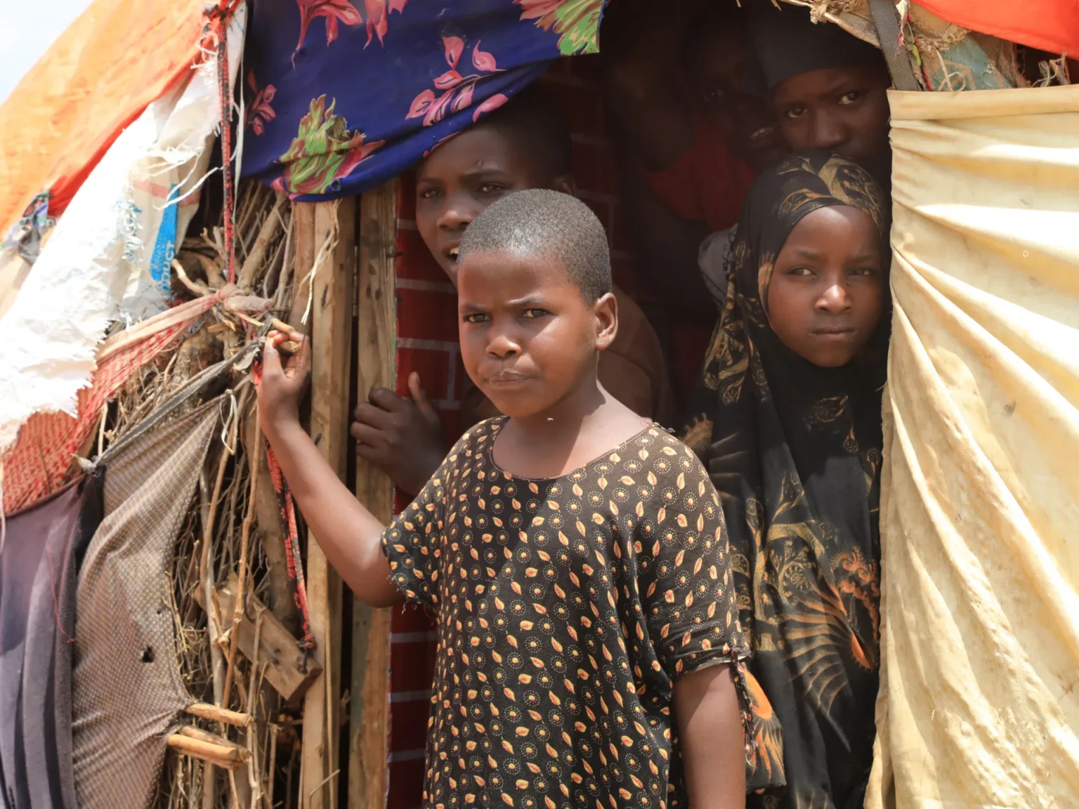 MSF warns of worsening malnutrition crisis among displaced children in Somalia