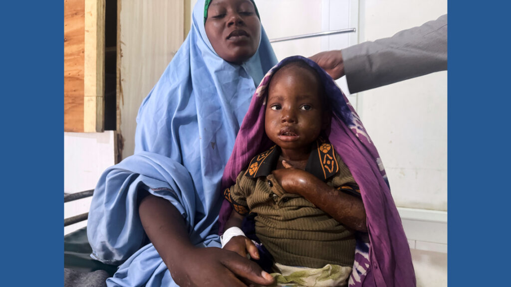 Mother’s 3-day walk with sick daughter highlights Somalia’s child malnutrition emergency